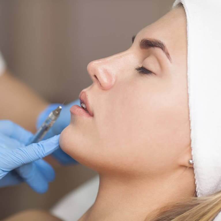 Woman receiving dermal facial filler